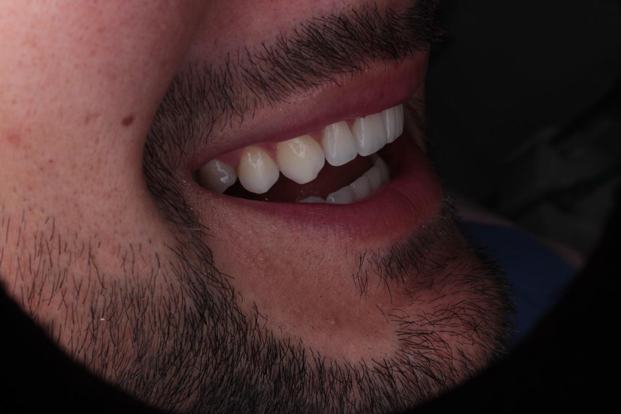 Periodoncia · tratamiento de encías