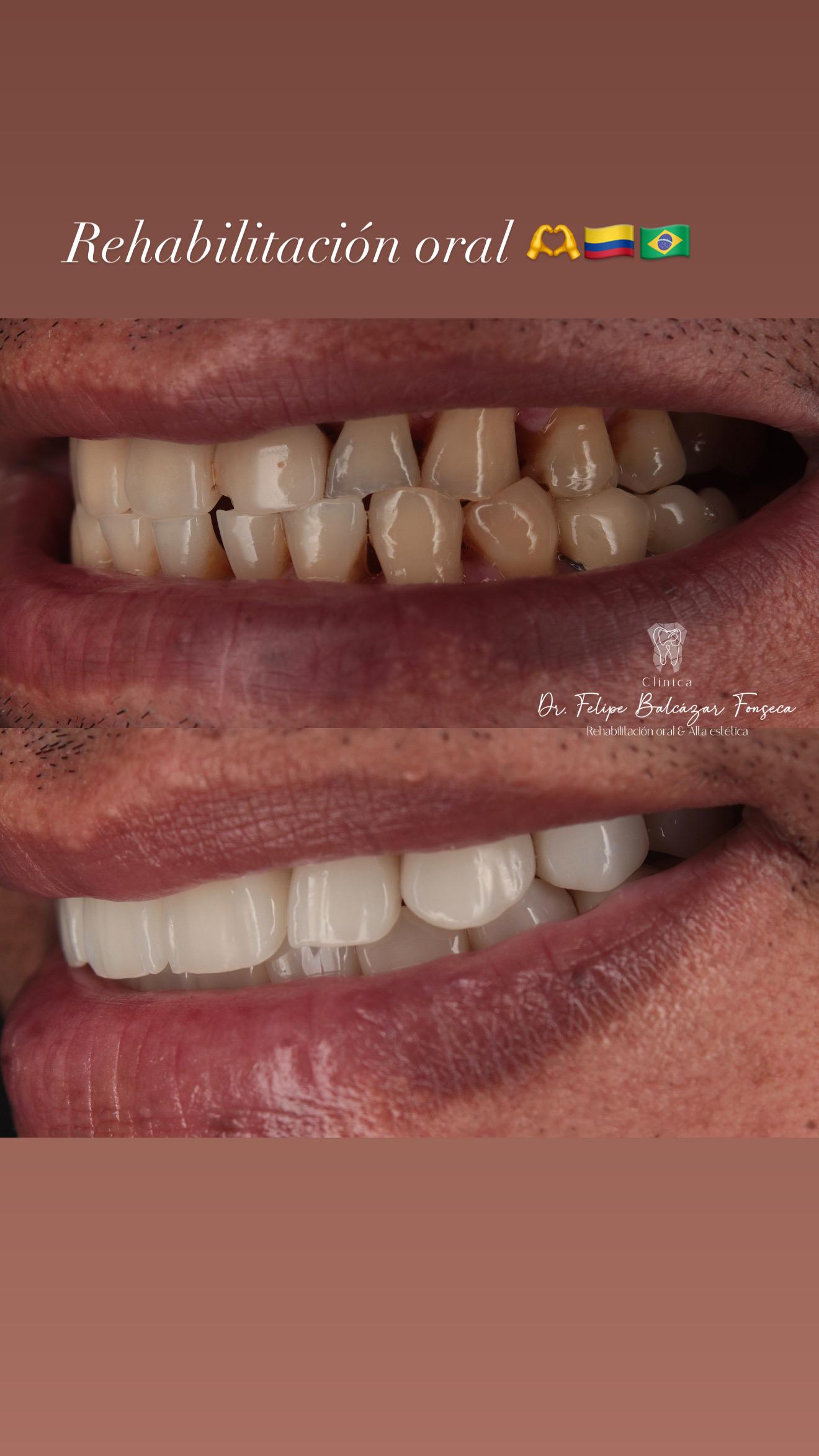 Endodoncia · microscopía operatoria
