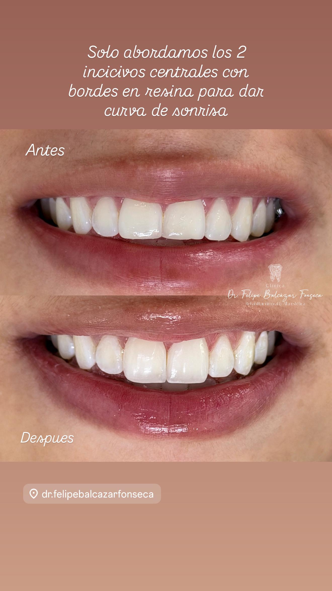 Diseño digital · planificación de sonrisa