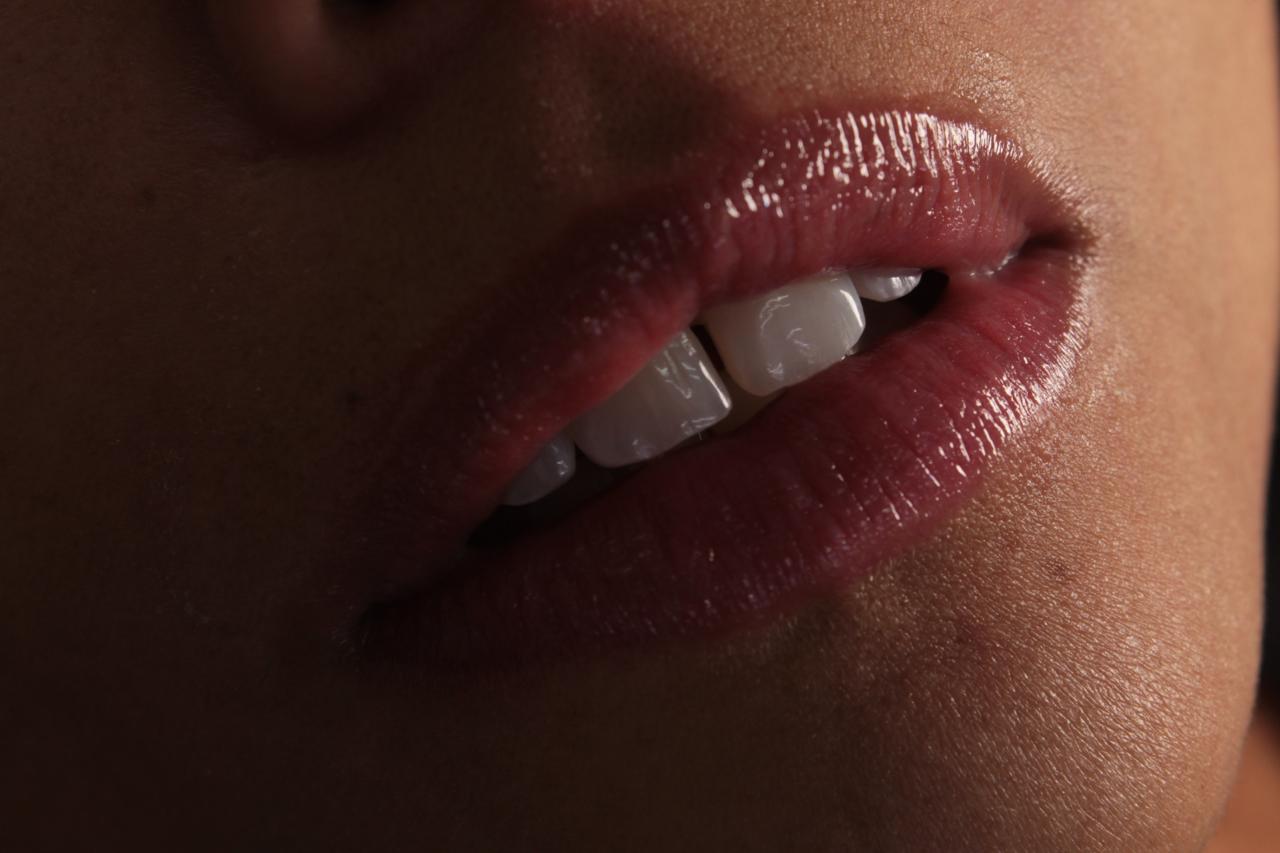 Armonización Orofacial