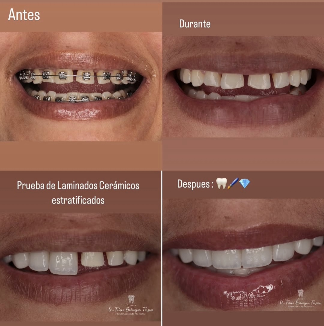 Ortodoncia y Ortopedia