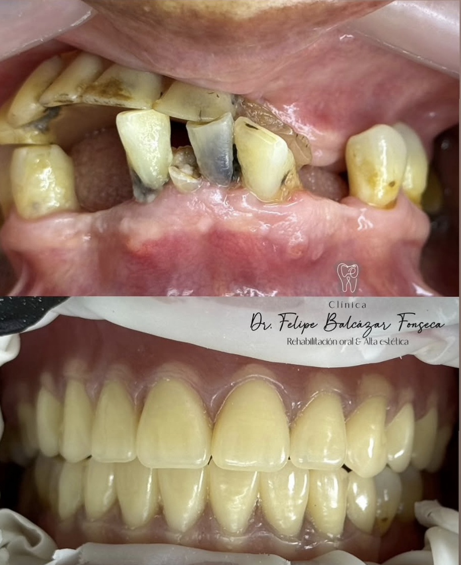 Rehabilitación Oral